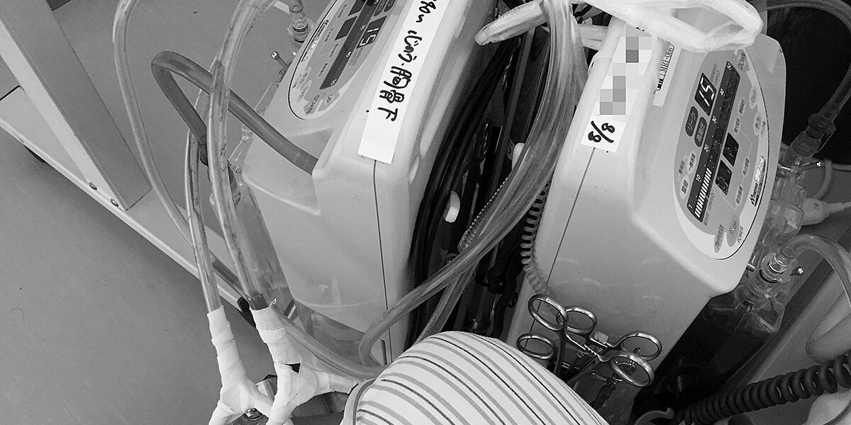 冠動脈バイパス手術後